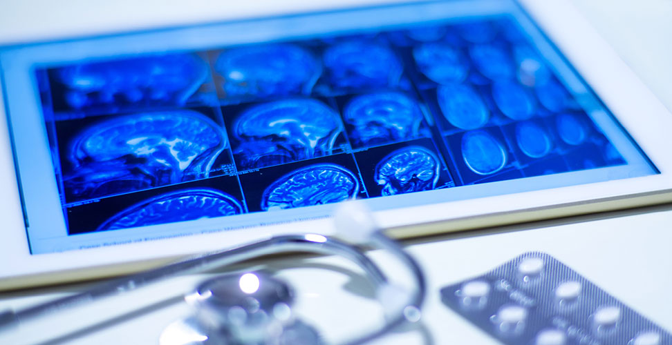 Digital images of a brain scan on an tablet computer with stethoscope and medication in foil packet in foreground