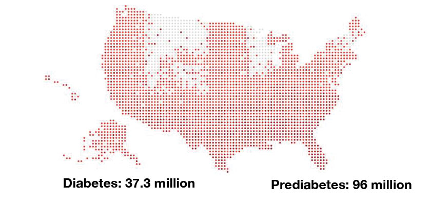 Map of the United States made up of dots showing prevalence of diabetes and prediabetes